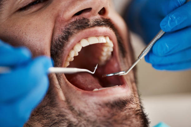 Best Chipped Tooth Repair Near Me  in Erie, PA